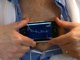 Utilisez votre iPhone 4 comme électrocardiogramme