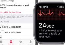 La fonctionnalité ECG sur Apple Watch Series 4 arrivera avec watchOS 5.1.2