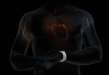 Alivecor Ecg Apple Watch
