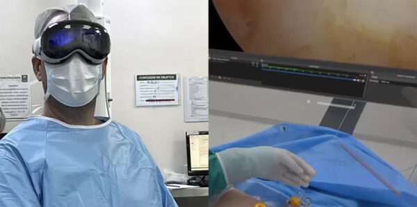 apple vision pro arthroscopie