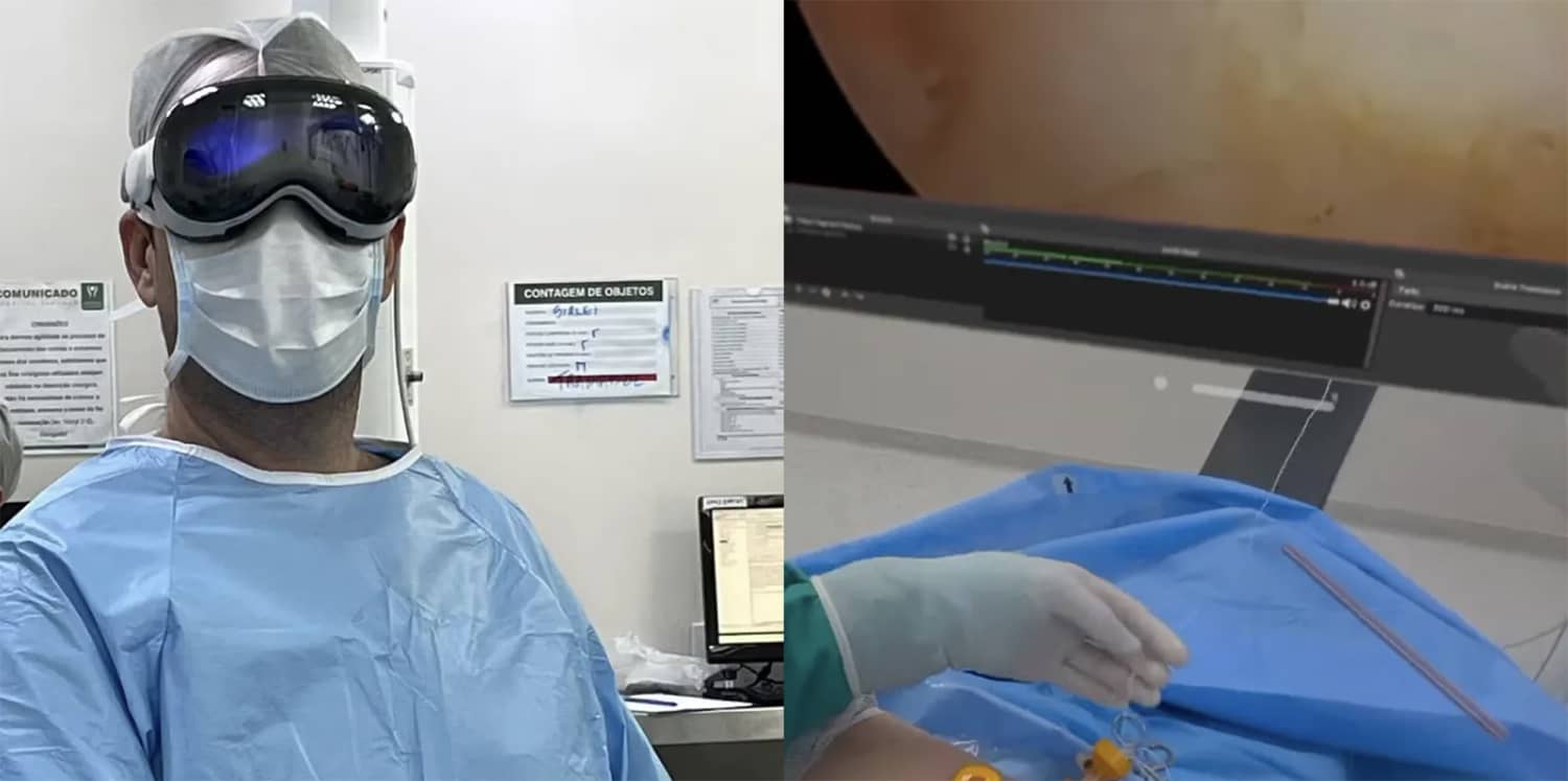 apple vision pro arthroscopie