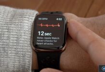 ecg apple watch.jpg